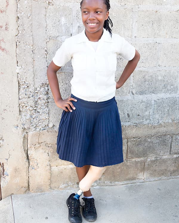 smiling young girl posing in front of a wall with her prosthetic leg crossed in front